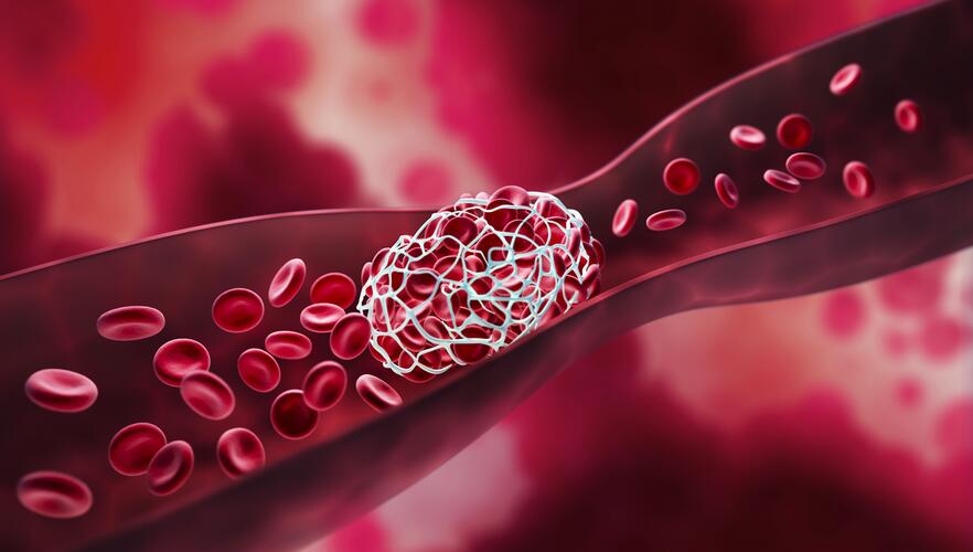  bung bluttransfusion